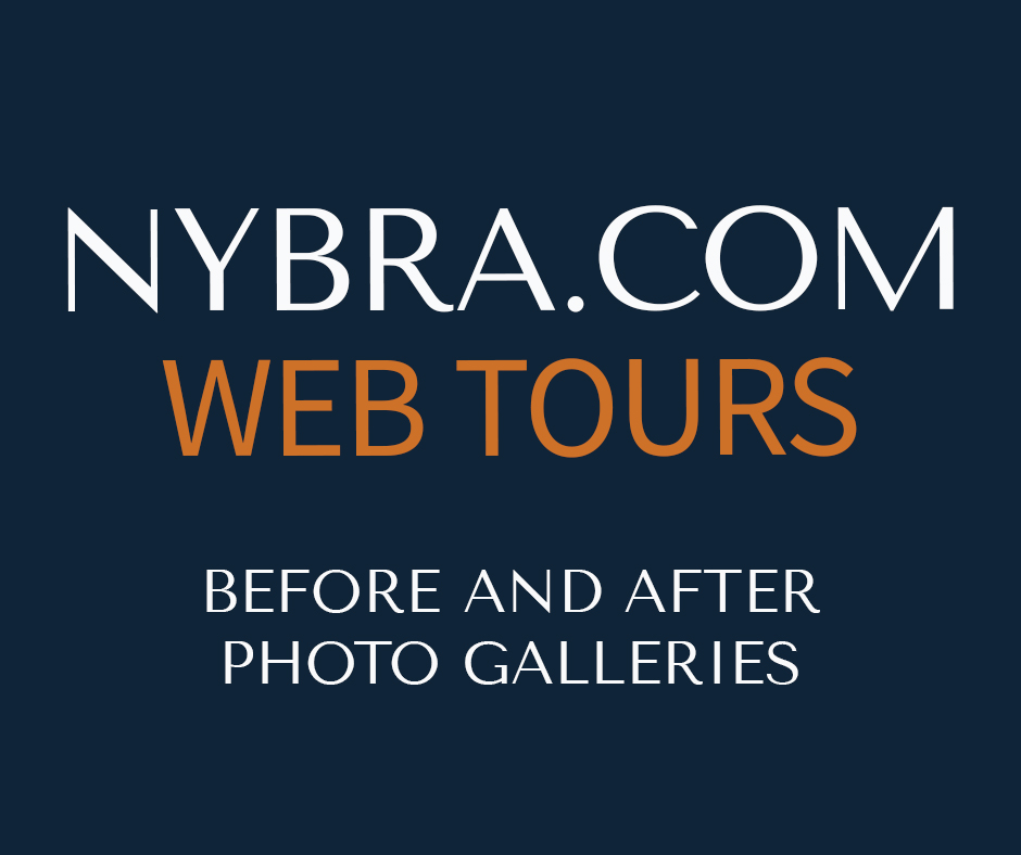 NYBRA.COM WEB TOURS: Before and After Photo Galleries square