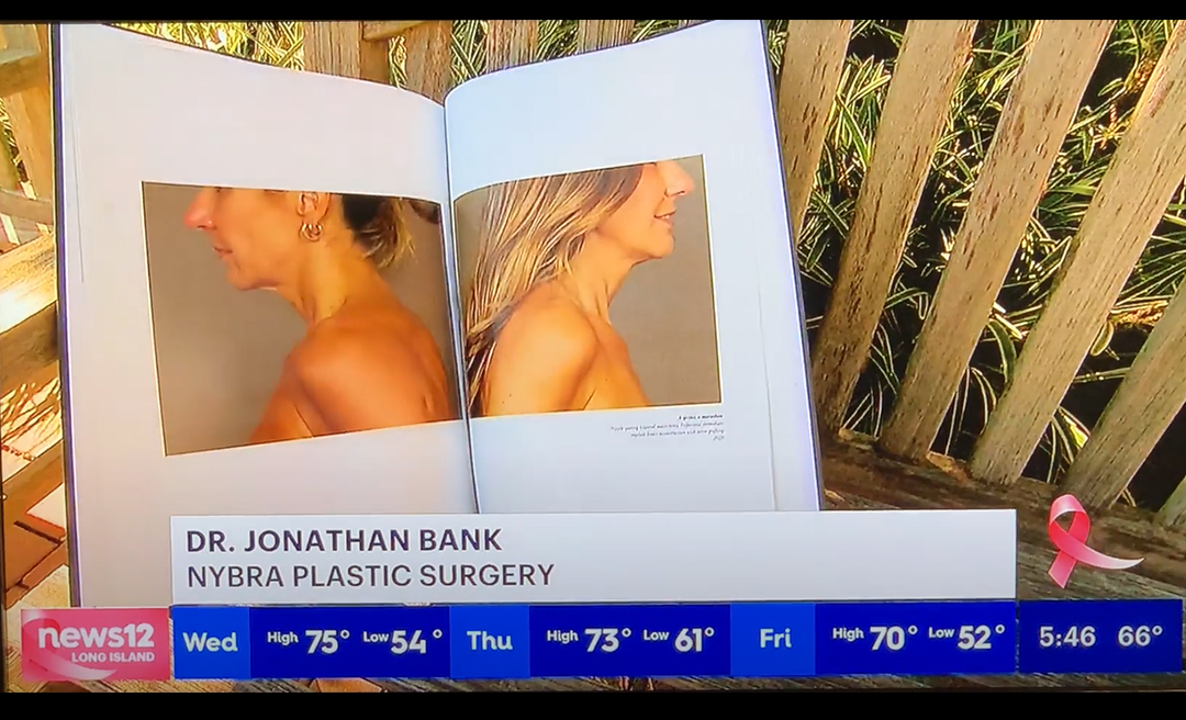screengrab of News12 segment of Dr. Bank's book Before the After