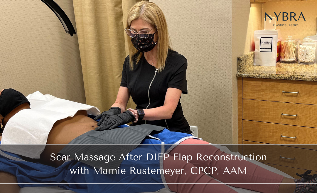 What's a DIEP flap reconstruction surgery? Well, after a