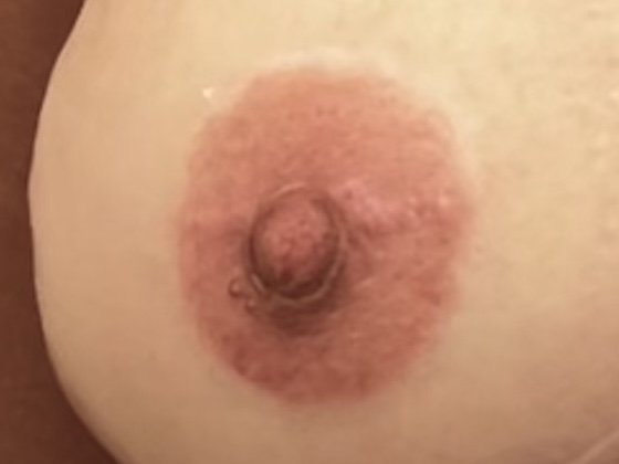 Nipple Tattoo Case 3 - After Alternative 2nd