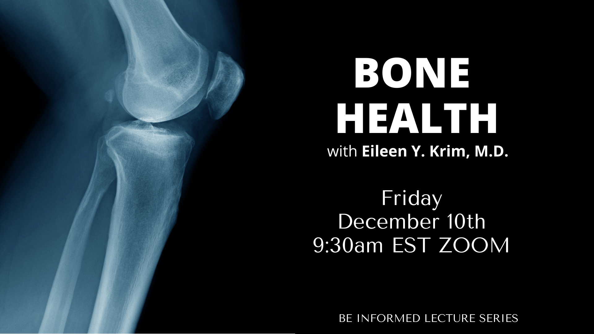 Black graphic with x ray of leg Bone Health lecture with Eileen Y. Krim, M.D.
