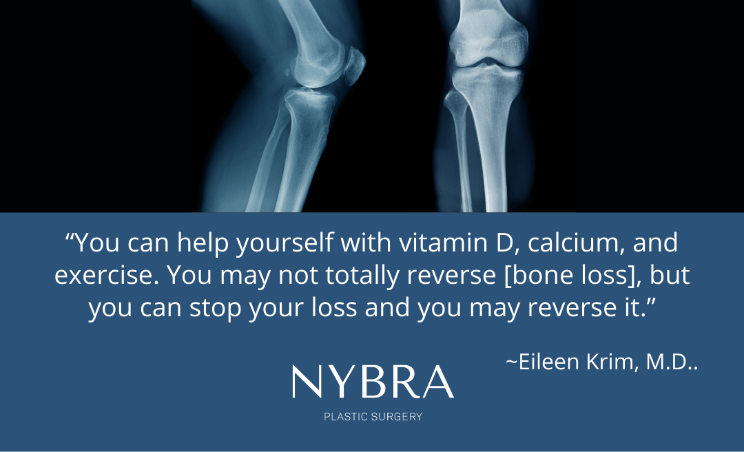 Bone Health recap quote and x-ray of legs