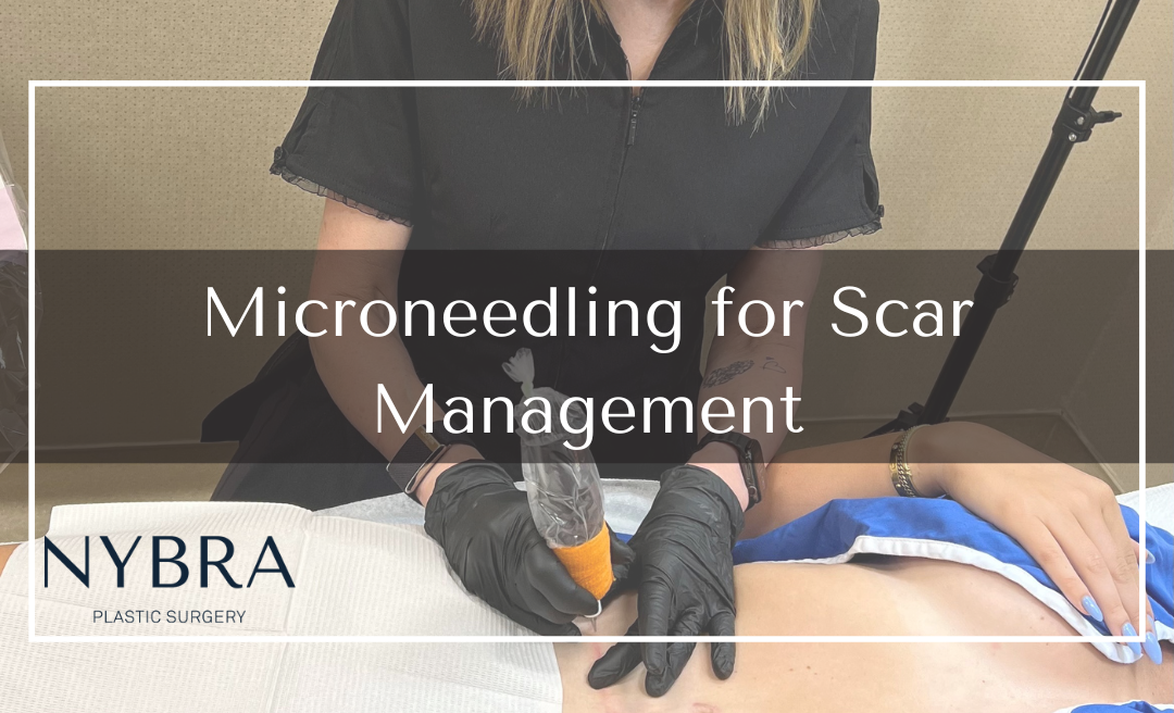 Microneedling for Scar Management