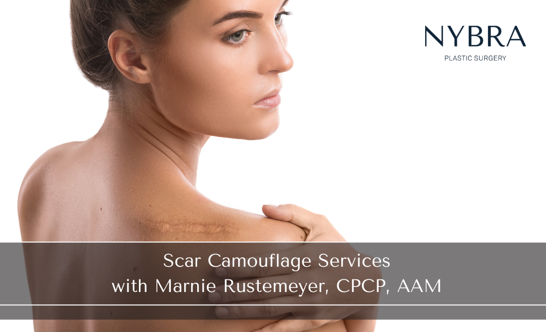 Women with Scar on Shoulder for Scar Camouflage Blog by Marnie Rustemeyer